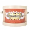 Rhinestone Hip Hop Top Bottom Teeth Grillz Set